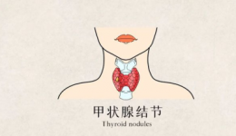 正确面对，勿要谈 “结”色变